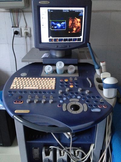 GE730彩超仪